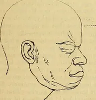 An illustration from The principles of phrenology (1838)