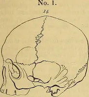 An illustration from The principles of phrenology (1838)