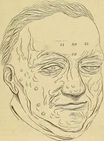 An illustration from The principles of phrenology (1838)