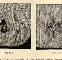 Picture 4 of 5 from Progressive lessons in the art and practice of needlework for use in schools (1893), leaf 91