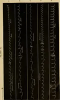 An illustration from The psychology of suggestion; a research into the subconscious nature of man and society (1898)