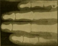An illustration from Radiography and the 'X' rays in practice and theory : with constructional manipulatory details (1898)