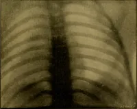 An illustration from Radiography and the 'X' rays in practice and theory : with constructional manipulatory details (1898)