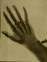 An illustration from Radiography and the 'X' rays in practice and theory : with constructional manipulatory details (1898)