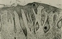 An illustration from Radium, X rays and the living cell (1915)