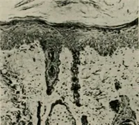 An illustration from Radium, X rays and the living cell (1915)