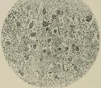 An illustration from Radium, X rays and the living cell (1915)
