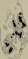 An illustration from Radium, X rays and the living cell (1915)
