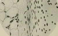An illustration from Radium, X rays and the living cell (1915)