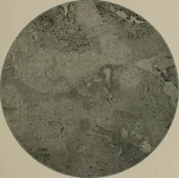 An illustration from Radium, X rays and the living cell (1915)