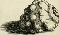 An illustration from Recreatio mentis, et oculi in observatione animalium testaceorum Italico sermone primum proposita ... nunc ... Latine oblata centum additis testaceorum iconibus .. (1684)