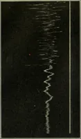 An illustration from Report (1915)