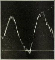 An illustration from Report (1915)