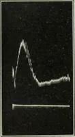 An illustration from Report (1915)