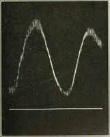 An illustration from Report (1915)