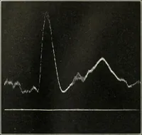 An illustration from Report (1915)