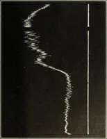 An illustration from Report (1915)