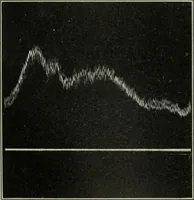 An illustration from Report (1915)