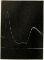 An illustration from Report (1915)
