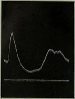An illustration from Report (1915)