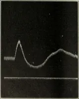 Picture 235 of 295 from Report (1915), leaf 537