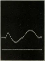 An illustration from Report (1915)