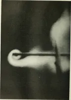 An illustration from Report (1915)