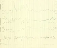 Picture 11 of 20 from Results of the magnetical and meteorological observations made at the Royal Observatory, Greenwich, in the year 1876[-82.] (1882), leaf 116
