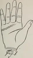 An illustration from Revelations of the hand. A scientific study of the shape and markings of the hand, as an index to character, disease, and tendencies, with explanatory illustrations (1900)