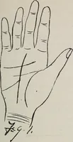 An illustration from Revelations of the hand. A scientific study of the shape and markings of the hand, as an index to character, disease, and tendencies, with explanatory illustrations (1900)