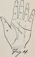 Picture 29 of 65 from Revelations of the hand. A scientific study of the shape and markings of the hand, as an index to character, disease, and tendencies, with explanatory illustrations (1900), leaf 114