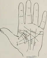 Picture 32 of 65 from Revelations of the hand. A scientific study of the shape and markings of the hand, as an index to character, disease, and tendencies, with explanatory illustrations (1900), leaf 130
