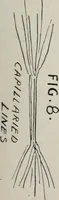 Picture 35 of 65 from Revelations of the hand. A scientific study of the shape and markings of the hand, as an index to character, disease, and tendencies, with explanatory illustrations (1900), leaf 138