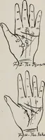 Picture 38 of 65 from Revelations of the hand. A scientific study of the shape and markings of the hand, as an index to character, disease, and tendencies, with explanatory illustrations (1900), leaf 146