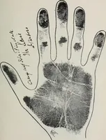Picture 52 of 65 from Revelations of the hand. A scientific study of the shape and markings of the hand, as an index to character, disease, and tendencies, with explanatory illustrations (1900), leaf 178
