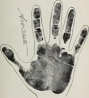 Picture 56 of 65 from Revelations of the hand. A scientific study of the shape and markings of the hand, as an index to character, disease, and tendencies, with explanatory illustrations (1900), leaf 186