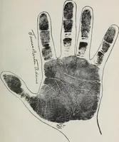 Picture 60 of 65 from Revelations of the hand. A scientific study of the shape and markings of the hand, as an index to character, disease, and tendencies, with explanatory illustrations (1900), leaf 194