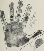 An illustration from Revelations of the hand. A scientific study of the shape and markings of the hand, as an index to character, disease, and tendencies, with explanatory illustrations (1900)
