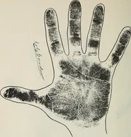 Picture 65 of 65 from Revelations of the hand. A scientific study of the shape and markings of the hand, as an index to character, disease, and tendencies, with explanatory illustrations (1900), leaf 203