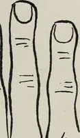 An illustration from Revelations of the hand. A scientific study of the shape and markings of the hand, as an index to character, disease, and tendencies, with explanatory illustrations (1900)