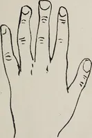 Picture 7 of 65 from Revelations of the hand. A scientific study of the shape and markings of the hand, as an index to character, disease, and tendencies, with explanatory illustrations (1900), leaf 52
