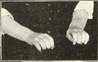 Picture 95 of 132 from Rhymes for little hands (1906), leaf 123
