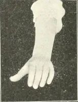 An illustration from Rhymes for little hands (1906)