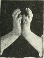 An illustration from Rhymes for little hands (1906)