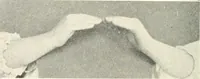 Picture 62 of 132 from Rhymes for little hands (1906), leaf 89