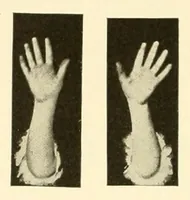 An illustration from Rhymes for little hands (1906)