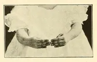 An illustration from Rhymes for little hands (1906)