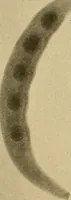 Picture 40 of 41 from Röntgenphotographie : Anleitung zu leicht auszuführenden Arbeiten mit statischer und galvanischer Elektrizität unter besonderer Berücksichtigung der Influenz-Elektrisiermaschine (1908), leaf 106