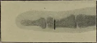 An illustration from The Röntgen rays in medical work (1899)