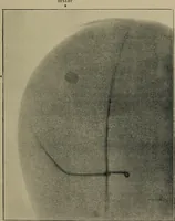 An illustration from The Röntgen rays in medical work (1899)